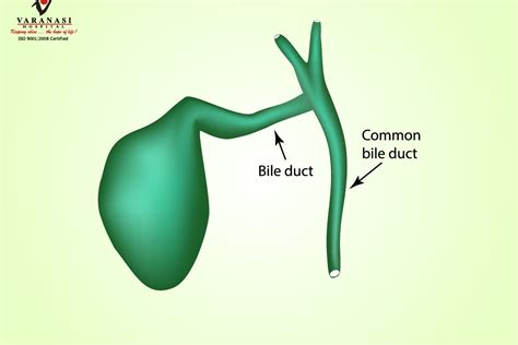 Common Bile Duct Exploration What And How