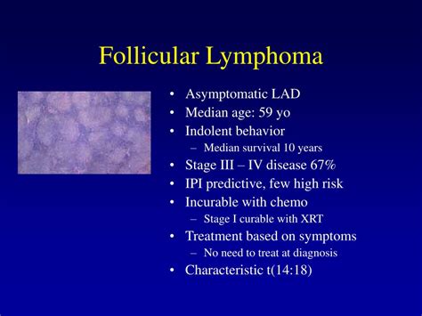 Ppt Lymphoma Presentation And Diagnosis Powerpoint Presentation Free