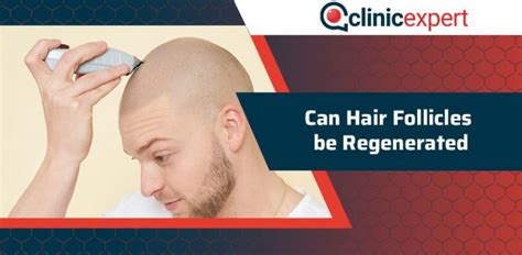 Can Hair Follicles Be Regenerated Clinicexpert