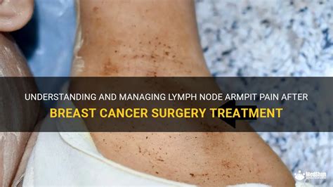 Understanding And Managing Lymph Node Armpit Pain After Breast Cancer