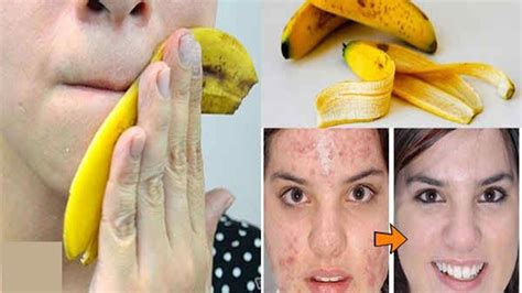 Stop Throwing Away Banana Peels 10 Ways You Can Use Them Health