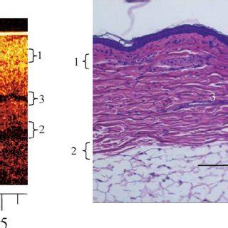 Oct Image And Histological Section Of Pig Skin Pig Points And