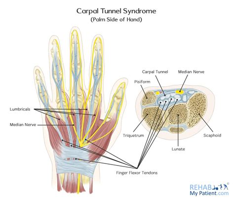 Anatomy Of Carpal Tunnel Anatomical Charts And Posters
