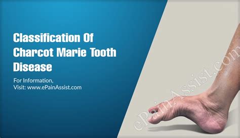 Consult a doctor for medical advice. Classification Of Charcot Marie Tooth Disease