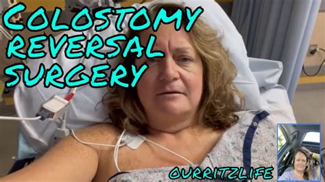 Colostomy Reversal Surgery Youtube