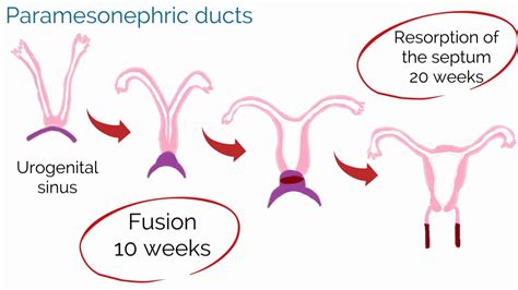 Atretic ovarian follicle an involuted ovarian follicle. APGO Basic Sciences - Topic 20: Mullerian Anomalies - YouTube