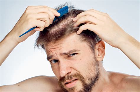 Hair Loss Treatments That Actually Work