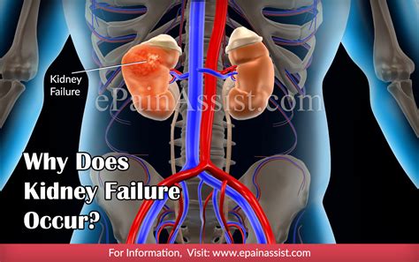 Symptoms Of Kidney Failure And Why Does Kidney Failure Occur