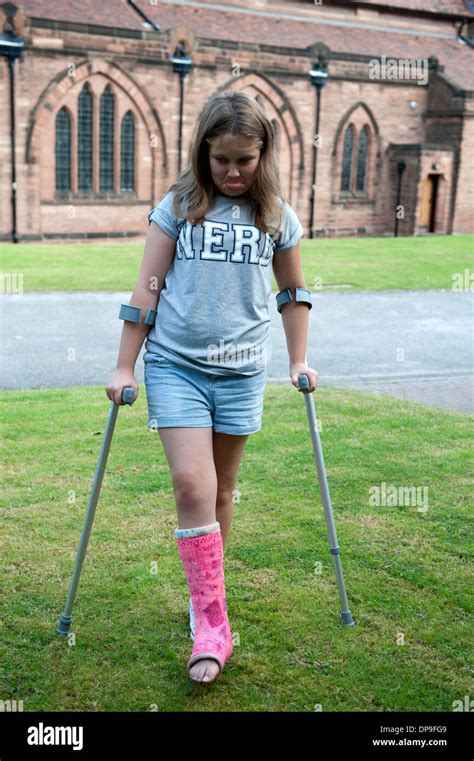 Leg Broken Girl Hi Res Stock Photography And Images Alamy