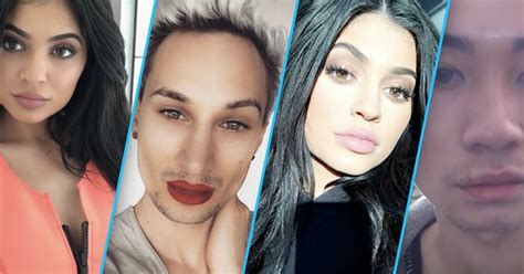 Why Lip Enhancement Is The Hottest Plastic Surgery Trend — Especially
