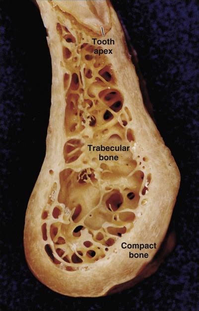 Trabecular Bone Tooth