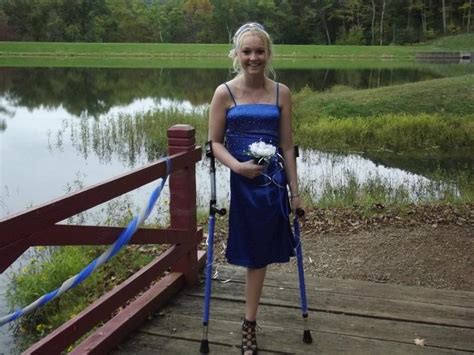 Crutches Amputee Strapless Dress Hips Match Pretty Wedding