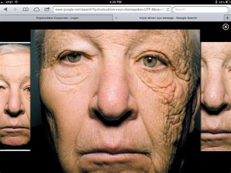 Proof Of The Aging Effects Of Prolonged Sun Exposure This Truck Driver