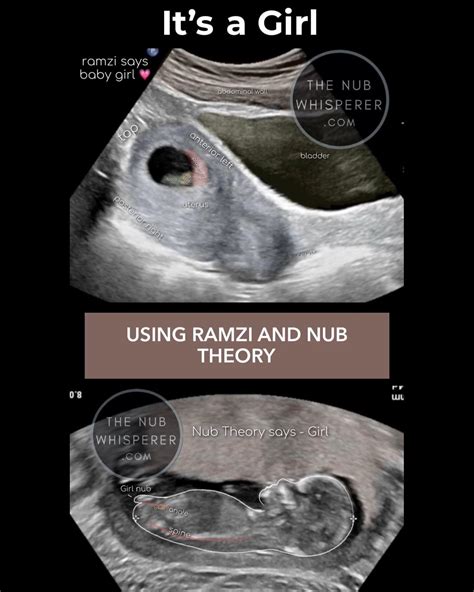 Confirmed Nub Theory The Nub Techs Nub Theory Early Gender Prediction