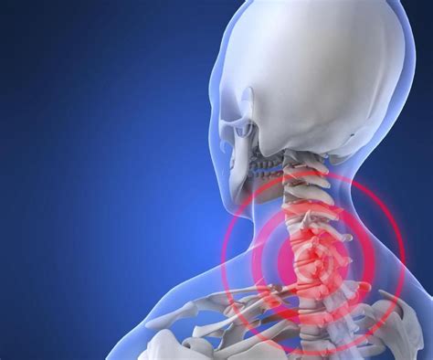 Secrets For Relief From Neck Pain Physio