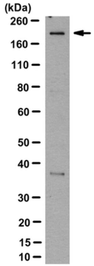 Access online via elsevier, 2006. Proteine Atlas Rat - Fantom Fantom5 : Netters atlas of ...