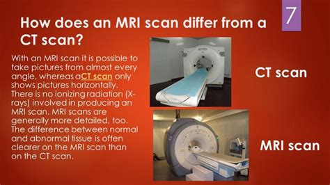 Learn the similarities and differences in the two scans and how you can prepare for your sometimes, these are referred to as cat scans, which stands for computerized axial tomography. 7 best the developmental stages in play images on ...