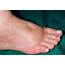 Foot Health Causes Of Swollen Feet And Ankles
