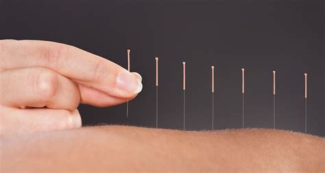 Acupuncture Yun Zhang Ac Clinique Dacupuncture Chinoise