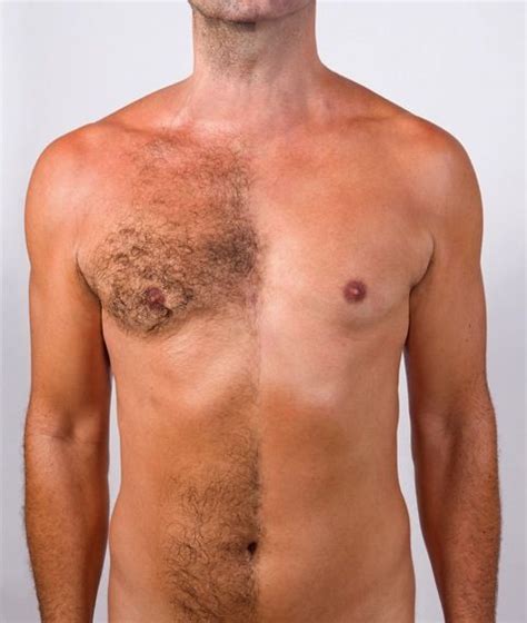 Before And After Manscaping Groin Designs Pictures Design Talk