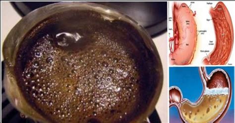 Discover what potentially causes stomach when gastric cancer involves the glands present on the lining of the stomach, it is known as the focus of this article is to describe the various risk factors associated with stomach cancer. Do You Drink Coffee In The Morning On An Empty Stomach ...