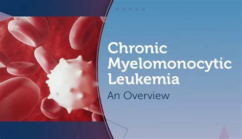 Chronic Myelomonocytic Leukemia An Overview Myleukemiateam