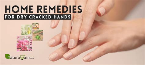 8 Home Remedies For Dry Cracked Hands 100 Pure Natural Treatment