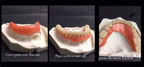 Diy denture kit is simple to use, kit comes with full upper & lower acrylic denture teeth (28) on wire preformed in shade a1 or a2 in sizes 22 large 23 medium 23 small comes with enough polymorph material pink strips of polymorph with white beaded polymorph ) to form gums. Do It Yourself Denture Kit Make Your Own Temporary Denture ...