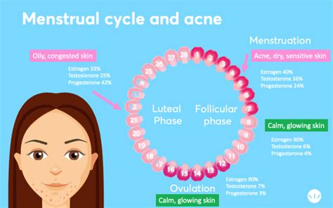 Hormonal Acne Best Treatment According To Dermatologists Mdacne