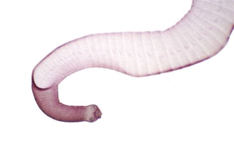 Best Pork Tapeworm Stock Photos Pictures And Royalty Free Images Istock