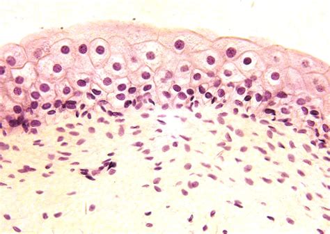 Transitional Epithelium Plump Boxy Cells At Apical Surface Thinner