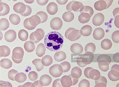 Neutrophil White Blood Cell Nucleus The Most Common Wbc And An