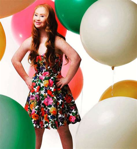 Australian Model With Down Syndrome Makes Catwalk Debut At New York Fashion Week Nova 969