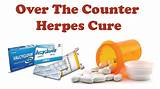Pictures of Herpes Holistic Cure