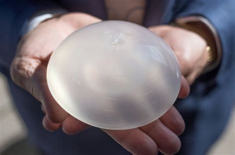 Reports Of Breast Implant Illnesses Prompt Federal Review The New
