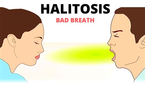 dental infographics showing main causes of halitosis or bad breath prestige dental care