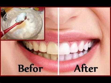 8 easy ways to make your teeth whiter at home. DIY Teeth Whitening at Home in 2 minutes - YouTube