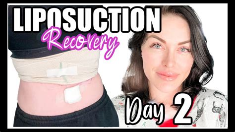 Recovery Time For Liposuction Liposuction Recovery Post Op Day 2