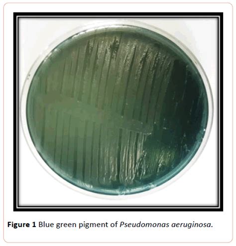 Antimicrobial Effect Of Pyocyanin Extracted From Pseudomonas Aeroginosa