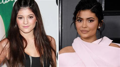 Kylie Jenners Transformation Personal Life And Career Otakukart