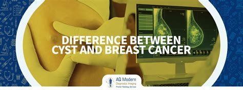 Difference Between Cyst And Breast Cancer A Comprehensive Guide Aq