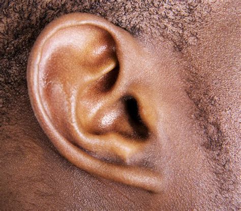 What Are The Different Types Of Hearing Loss With Pictures