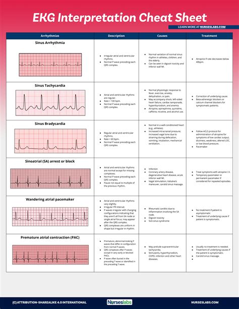 Ekg Interpretation Cheat Sheet And Heart Arrhythmias Guide
