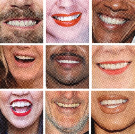 The History Of The Big Bright American Smile Tgihealthcareerp