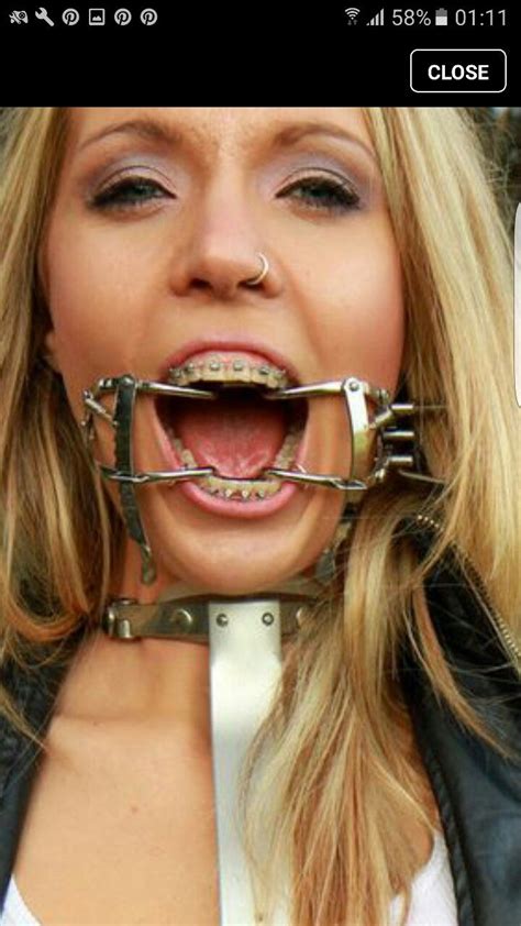 Pin On Braces Are Hot