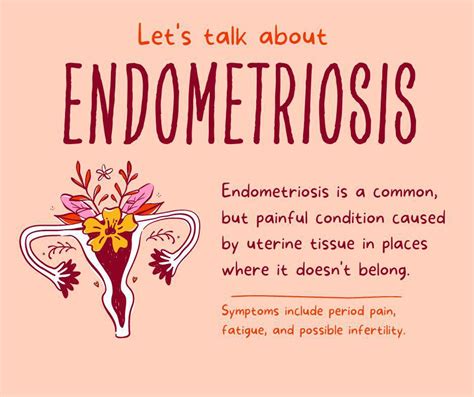 endometriosis awareness piedmont preferred women s healthcare ob gyns