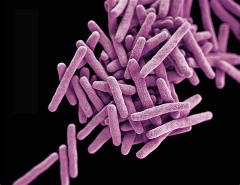 Tuberculosis (tb) is an infectious disease usually caused by mycobacterium tuberculosis (mtb) bacteria. Tuberculosis bacteria thrive on a nitrogen-source buffet ...