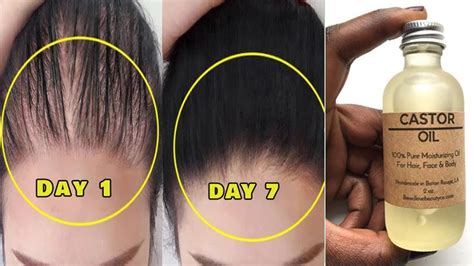 7 Day Hair Regrowth Challenge With Castor Oil Double Hair Growth Castor Oil For Hair Growth