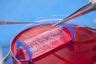 Lab Grown Vaginas Have Been Successfully Implanted In Four Women The