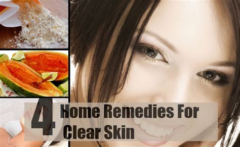 4 Home Remedies For Clear Skin How To Get Clear Skin Naturally Find